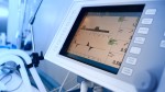 Mechanical Ventilation (MV) - Basic